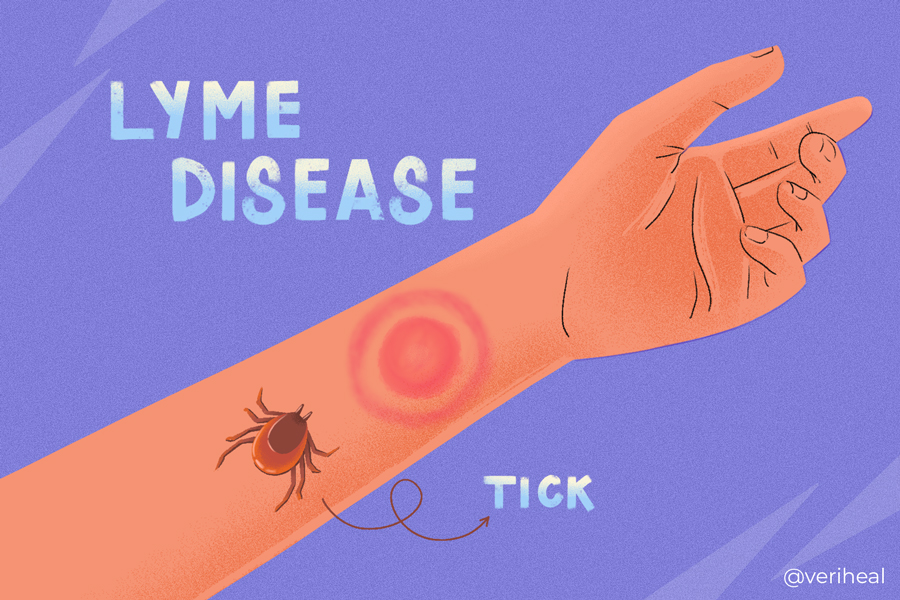 Lyme_disease